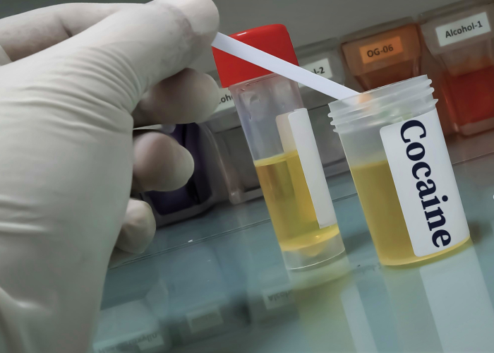 Urine test for Cocaine