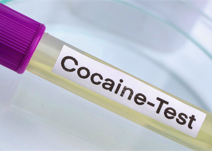 cocaine urine test sample