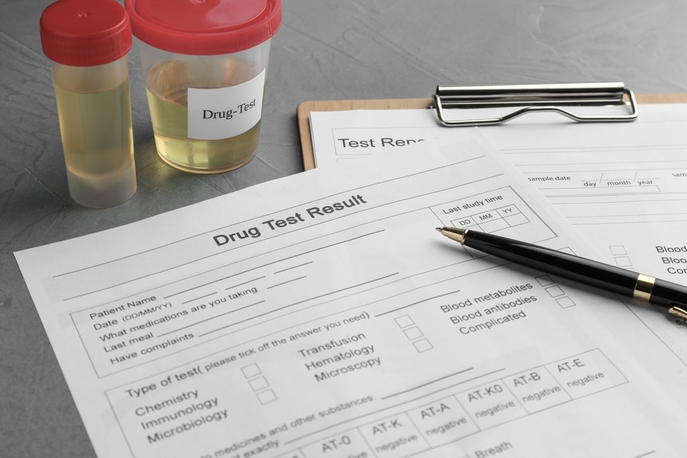 Drug test result form, containers with urine samples