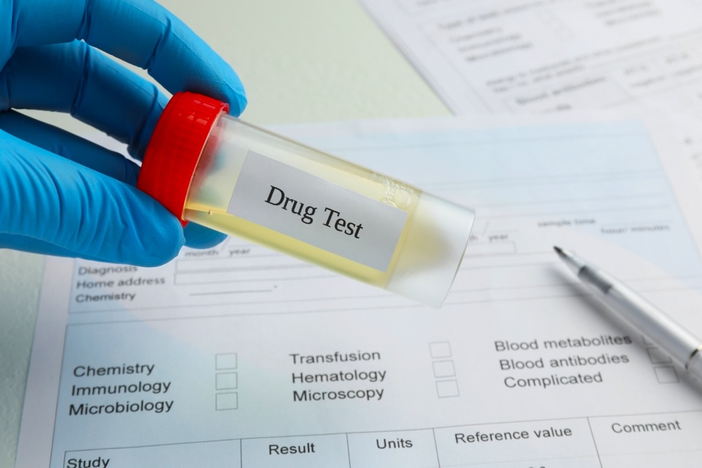 Laboratory worker holding container with urine sample over medical form on table